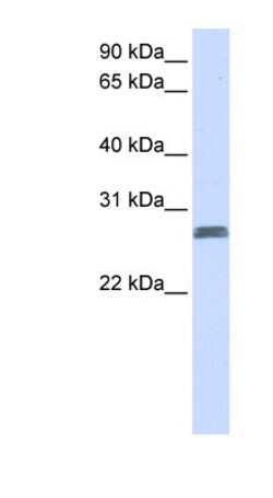 TMEM51 Antibody, Novus Biologicals 20&mu;L; Unlabeled:Antibodies, Polyclonal